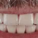 Advanced Dental Group & Orthodontics