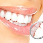 Hanhan Dental