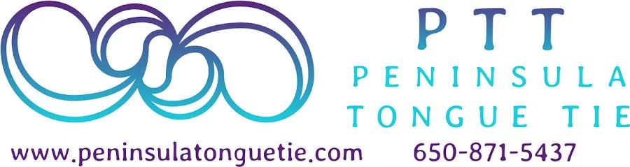 Peninsula Tongue Tie Picture 1