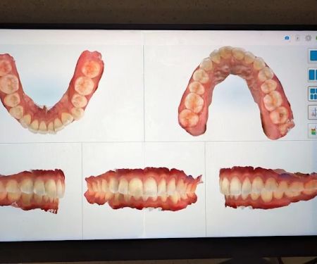 South San Francisco Heart Dentistry