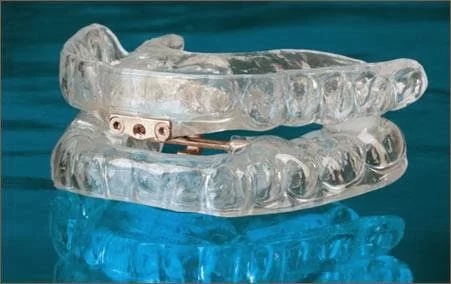 Bay Area Sleep Apnea Oral Appliance Center Picture 1