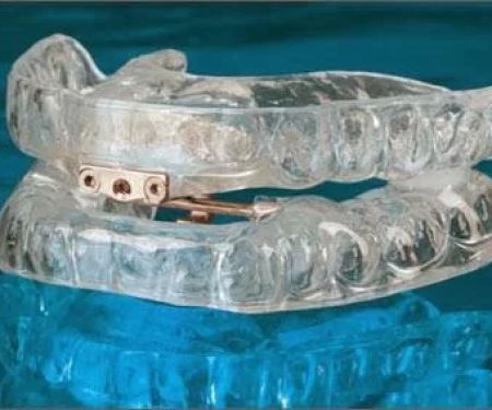 Bay Area Sleep Apnea Oral Appliance Center