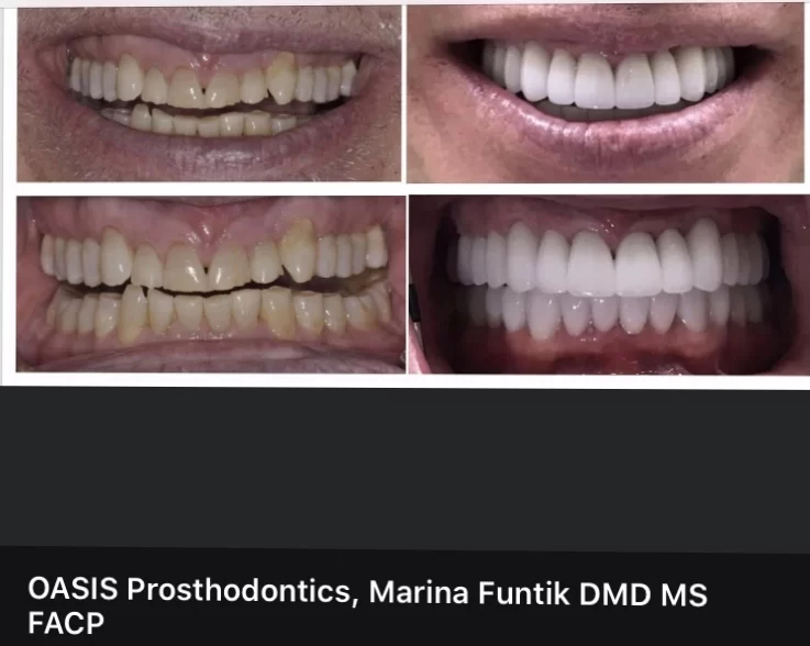 Oasis Prosthodontics, Marina Funtik, DMD, MS, FACP 4