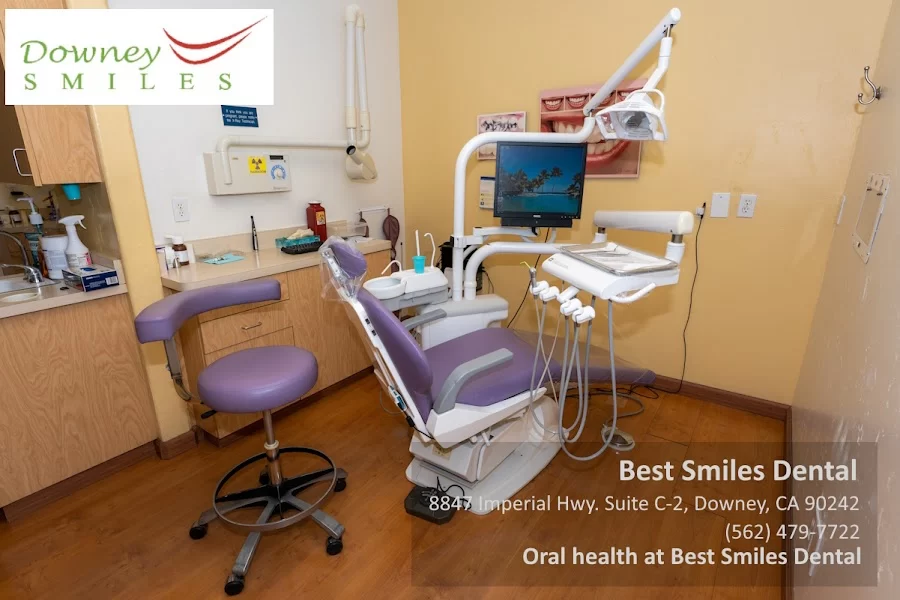 Downey Dentist by Best Smiles Dental 3