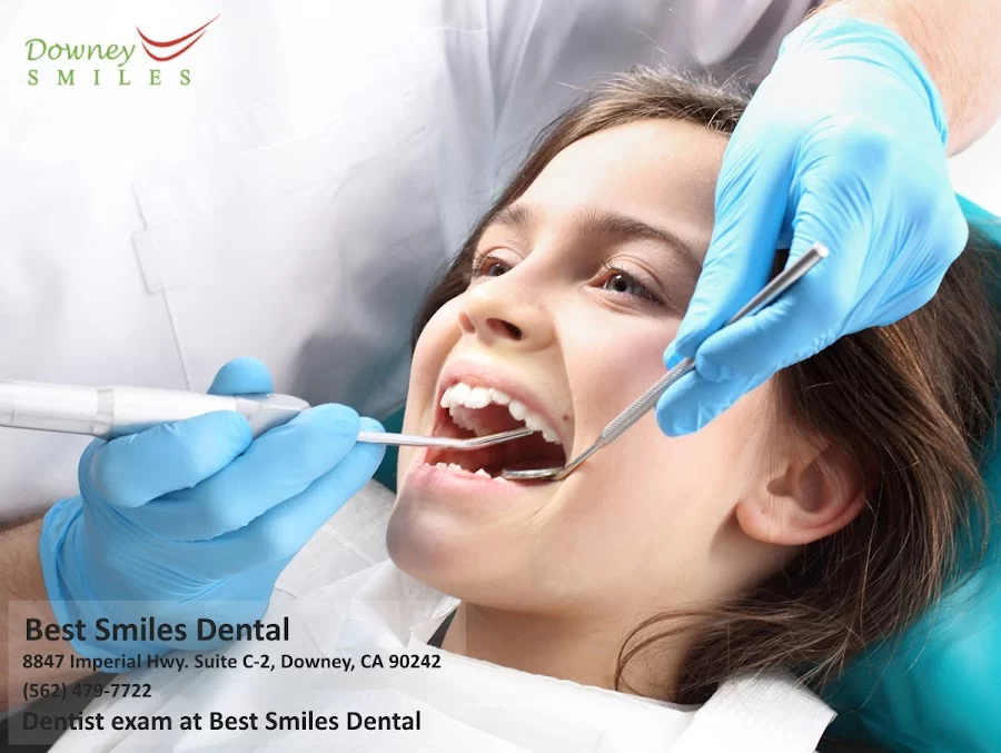 Downey Dentist by Best Smiles Dental 10