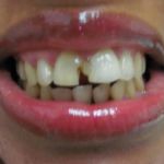 Brunswick Dental Associate-Dentista Hispana New Brunswick