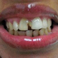 Brunswick Dental Associate-Dentista Hispana New Brunswick ico