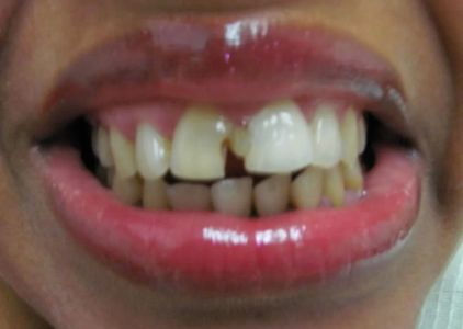Brunswick Dental Associate-Dentista Hispana New Brunswick