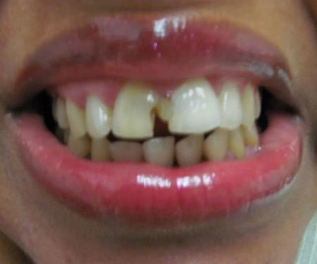 Brunswick Dental Associate-Dentista Hispana New Brunswick