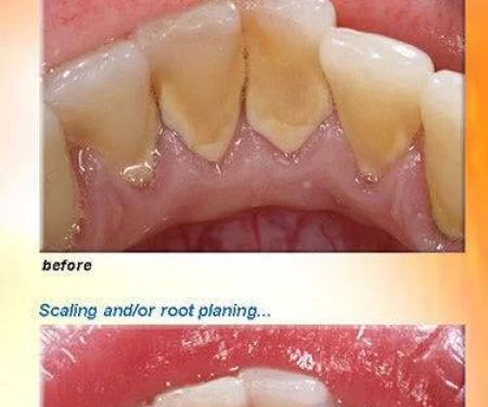Heavenly Dental Smiles Inc.