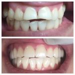PhD Dental Los Angeles Kids, Family & Orthodontics