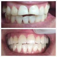 PhD Dental Los Angeles Kids, Family & Orthodontics ico