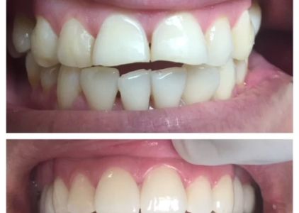 PhD Dental Los Angeles Kids, Family & Orthodontics