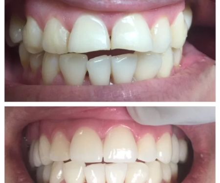 PhD Dental Los Angeles Kids, Family & Orthodontics