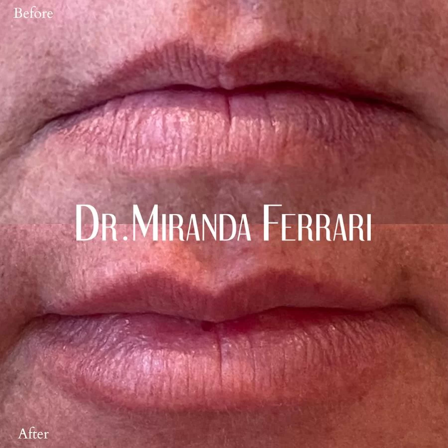 Ferrari Facial Aesthetics 4