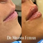 Ferrari Facial Aesthetics
