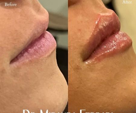 Ferrari Facial Aesthetics