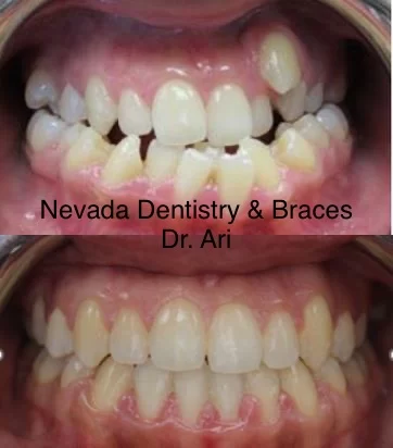 Nevada Dentistry & Braces 2