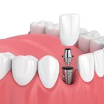 Nevada Dentistry & Braces