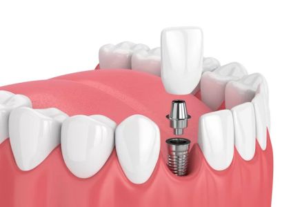 Nevada Dentistry & Braces