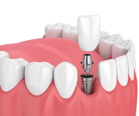 Nevada Dentistry & Braces