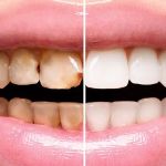 Reed Dental