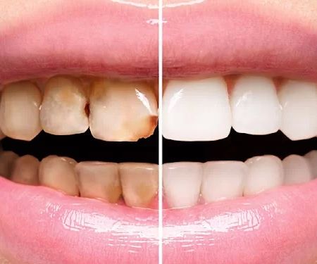 Reed Dental