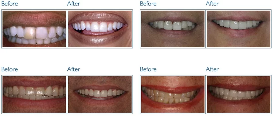 Gage Dental Care 3