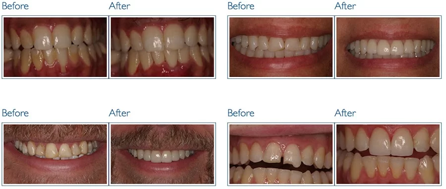 Gage Dental Care 2