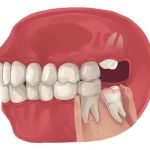 Summit Smiles / Dental Care: La Habra