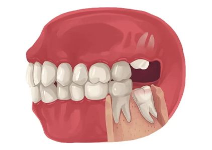 Summit Smiles / Dental Care: La Habra