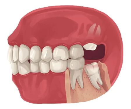 Summit Smiles / Dental Care: La Habra