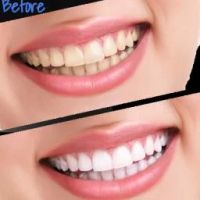 Feel Good Dental ico