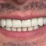 Beauty Smiles Dental Wael H. Obeid, DDS