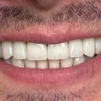 Beauty Smiles Dental Wael H. Obeid, DDS ico