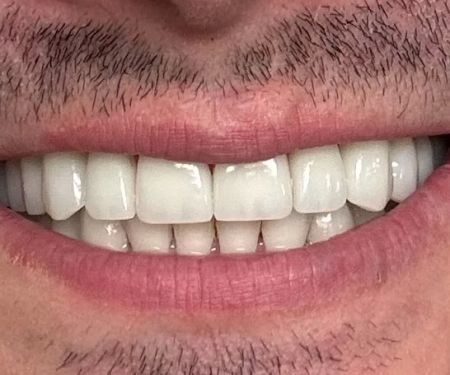 Beauty Smiles Dental Wael H. Obeid, DDS