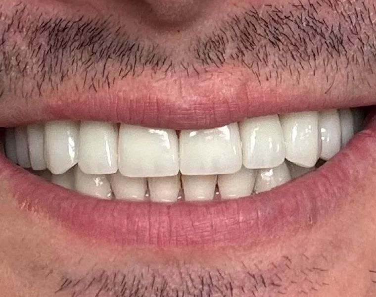 Beauty Smiles Dental Wael H. Obeid, DDS