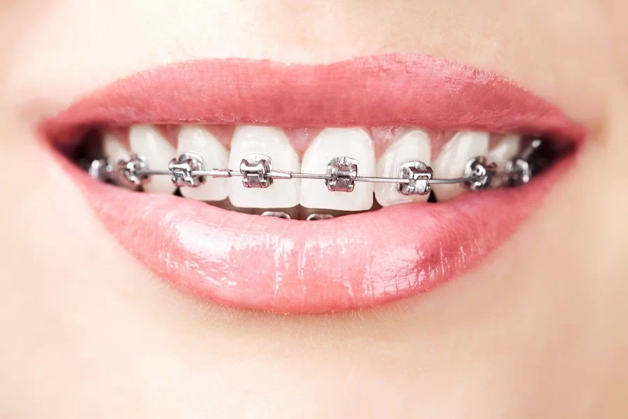 Summer Smile Dental South Gate 1