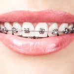 Summer Smile Dental South Gate