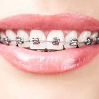 Summer Smile Dental South Gate ico