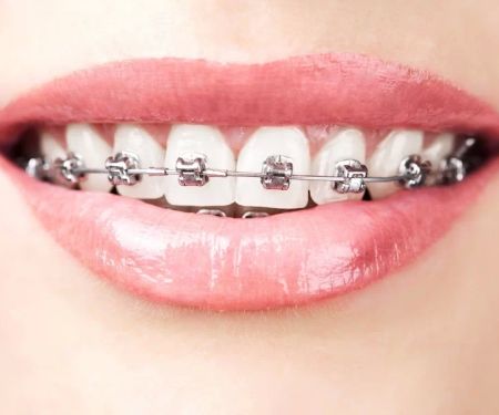 Summer Smile Dental South Gate