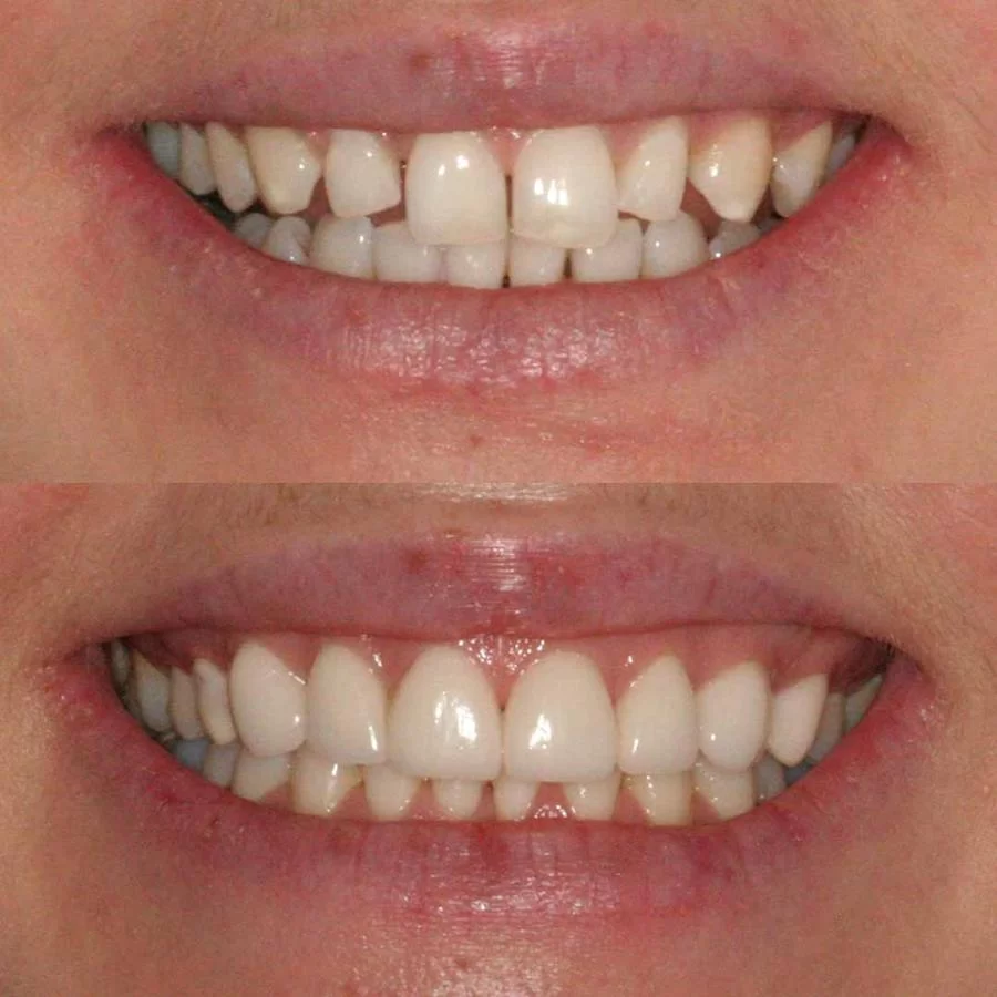 Summer Smile Dental South Gate 10
