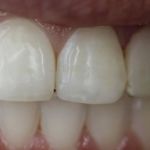 Tarzana Smiles - Garo Ourfalian, DDS