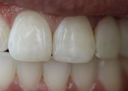 Tarzana Smiles - Garo Ourfalian, DDS