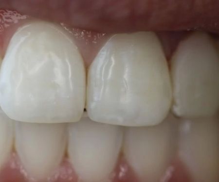 Tarzana Smiles - Garo Ourfalian, DDS