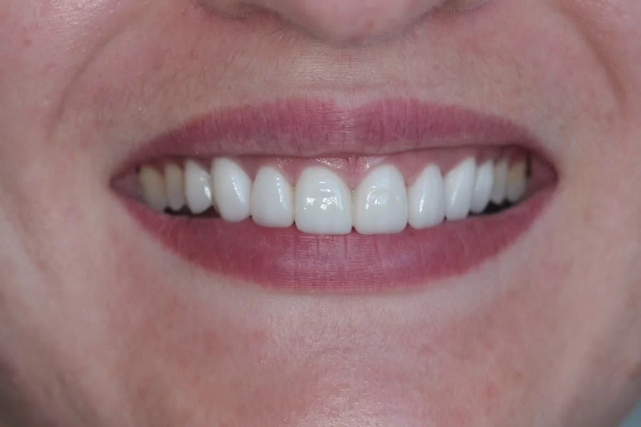 Tarzana Smiles - Garo Ourfalian, DDS 4