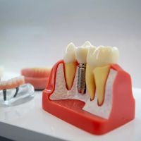 Synergy Dental Implant & Oral Surgery Center ico