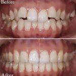 Pearl Zadeh DDS