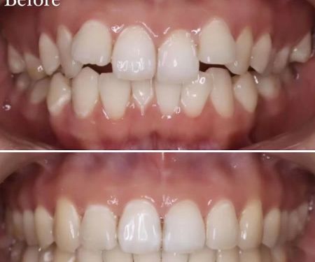 Pearl Zadeh DDS