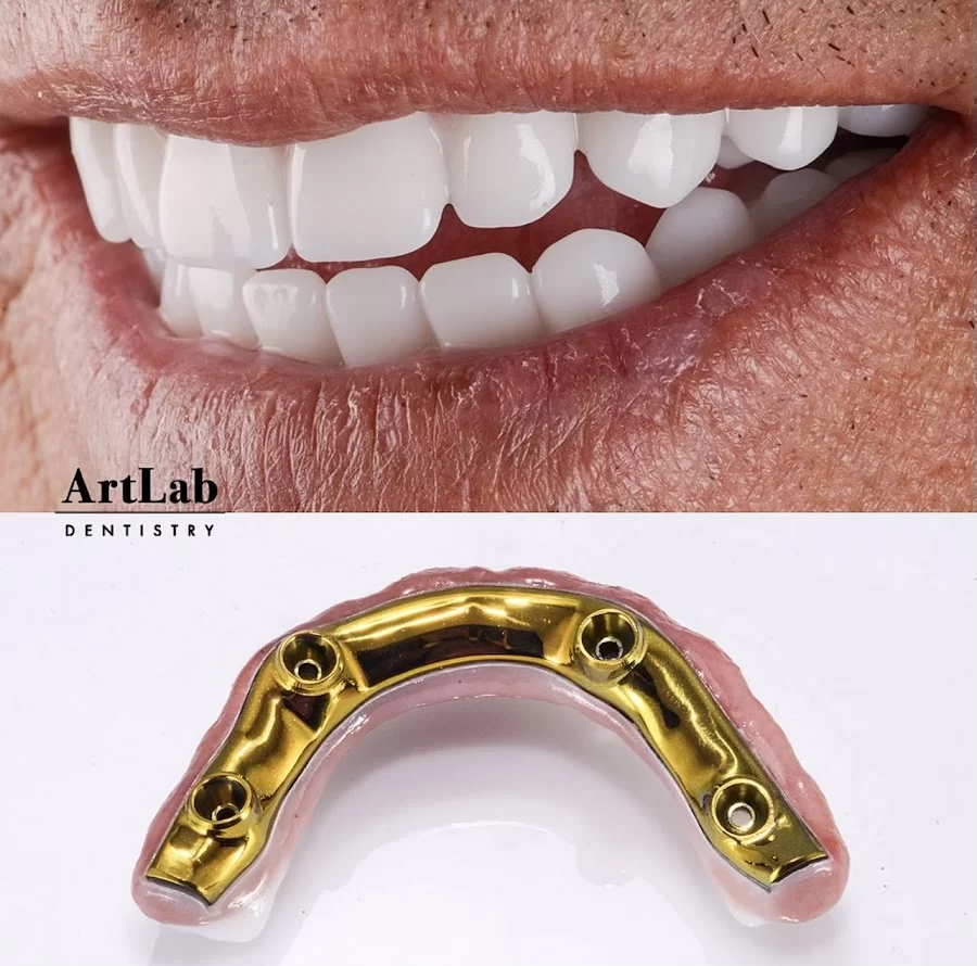 ArtLab Dentistry 9